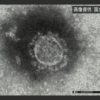 新型ウイルス 中国以外の感染者 27の国と地域で計364人 | NHKニュース